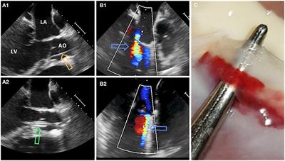 Septaly Oriented Mild Aortic Regurgitant Jets Negatively Influence Left Ventricular Blood Flow—Insights From 4D Flow MRI Animal Study